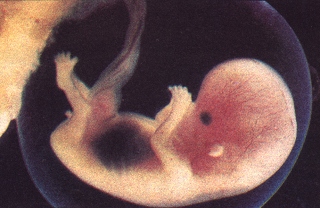 13 week old Baby in Mother's Womb